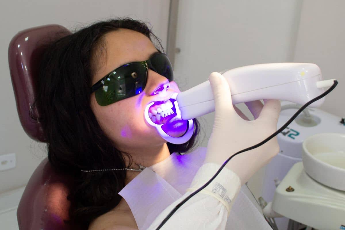 Blanqueamiento dental con luz ultravioleta